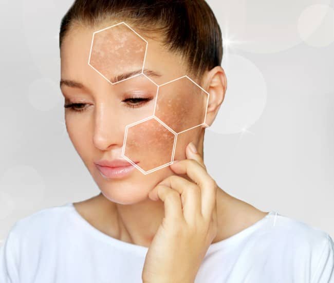 Advance Laser Pigmentation