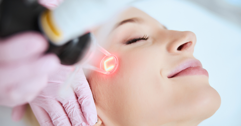 Advance Laser Whitening