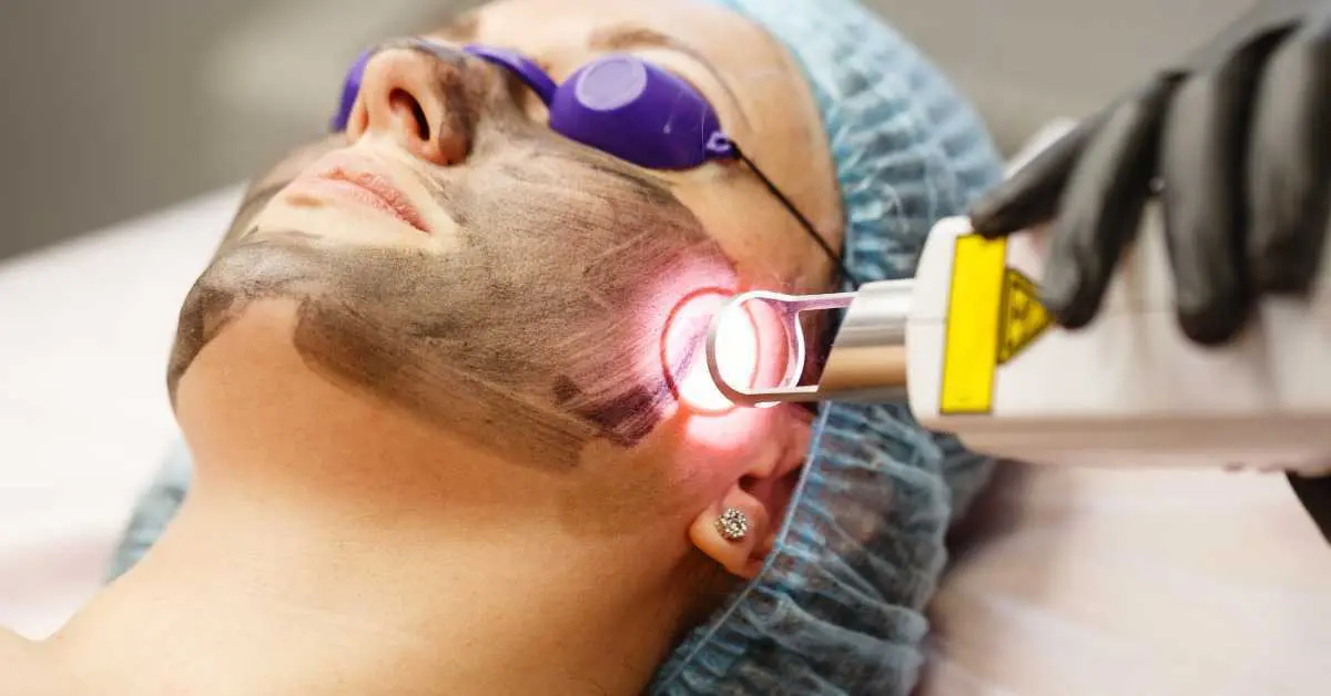 Laser Whitening Treatment